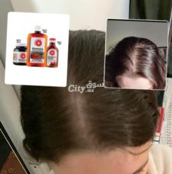 مجموعة الفلفل لتساقط الشعر - 4